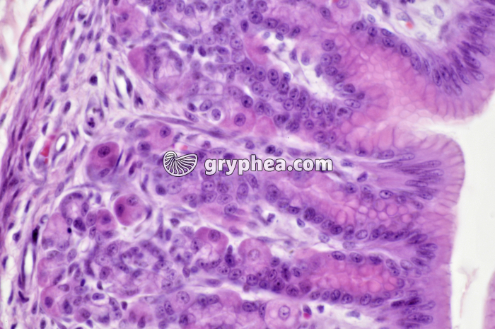 Estomac pylorique x160 - gryphea.org